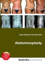 Abdominoplasty