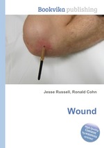 Wound