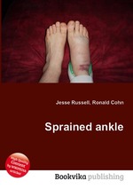 Sprained ankle