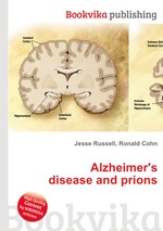 Alzheimer`s disease and prions