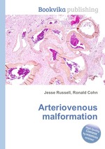 Arteriovenous malformation