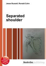 Separated shoulder