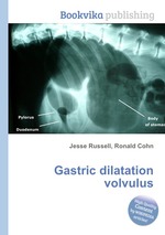 Gastric dilatation volvulus