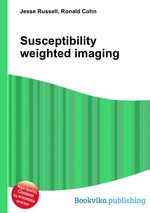 Susceptibility weighted imaging