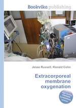 Extracorporeal membrane oxygenation