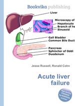 Acute liver failure