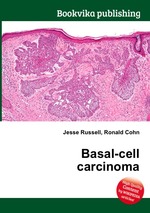 Basal-cell carcinoma