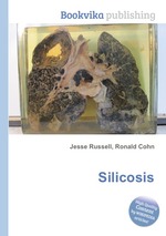 Silicosis