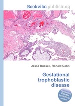 Gestational trophoblastic disease