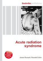 Acute radiation syndrome