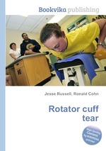 Rotator cuff tear