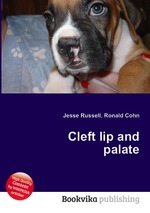 Cleft lip and palate