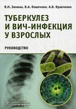 Туберкулез и ВИЧ-инфекция у взрослых