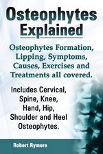 Osteophytes Explained. Osteophytes Formation, Lipping, Symptoms, Causes, Exercises and Treatments All Covered. Includes Cervical, Spine, Knee, Hand, H