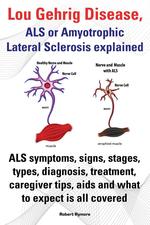 Lou Gehrig Disease, ALS or Amyotrophic Lateral Sclerosis Explained. ALS Symptoms, Signs, Stages, Types, Diagnosis, Treatment, Caregiver Tips, AIDS and