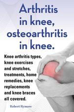 Arthritis in knee, osteoarthritis in knee. Knee arthritis types, knee exercises and stretches, treatments, home remedies, knee replacements and knee braces all covered