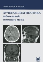 Лучевая диагностика заболеваний головного мозга