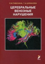 Церебральные венозные нарушения