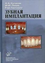 Зубная имплантация