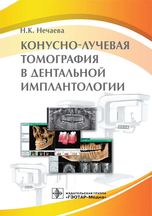 Конусно-лучевая томография в дентальной имплантологии (эл.версия)
