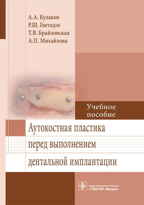 Аутокостная пластика перед выполнением дентальной имплантации. Учебное пособие (эл.версия)