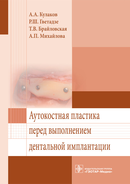 Аутокостная пластика перед выполнением дентальной имплантации (эл.версия)