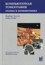 Компьютерная томография головы и позвоночника