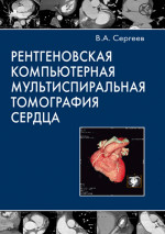 Рентгеновская компьютерная мультиспиральная томография сердца