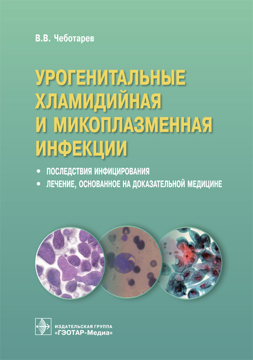 Урогенитальные хламидийная и микоплазменная инфекции. Последствия инфицирования, лечение, основанное на доказательной медицине