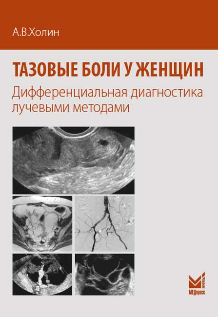 Тазовые боли у женщин