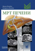 МРТ печени