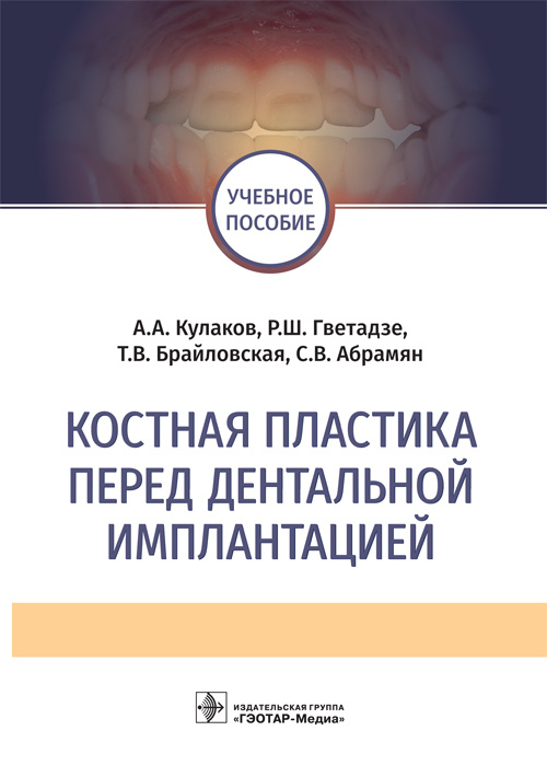 Костная пластика перед дентальной имплантацией. Учебное пособие