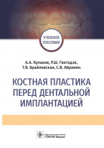 Костная пластика перед дентальной имплантацией. Учебное пособие