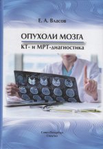 Опухоли мозга КТ- и МРТ- диагностика