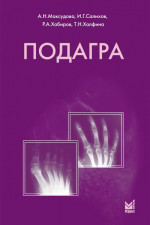 Подагра