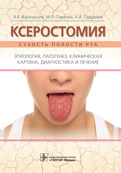 Ксеростомия. Сухость полости рта. Этиология, патогенез, клиническая картина, диагностика и лечение