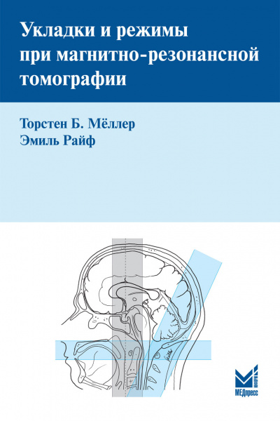 Укладки и режимы при магнитно-резонансной томографии