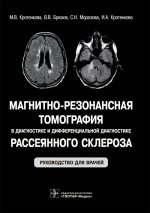 Магнитно-резонансная томография в диагностике и дифференциальной диагностике рассеянного склероза: руководство для врачей