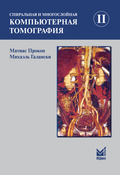 Спиральная и многослойная компьютерная томография. Том 2
