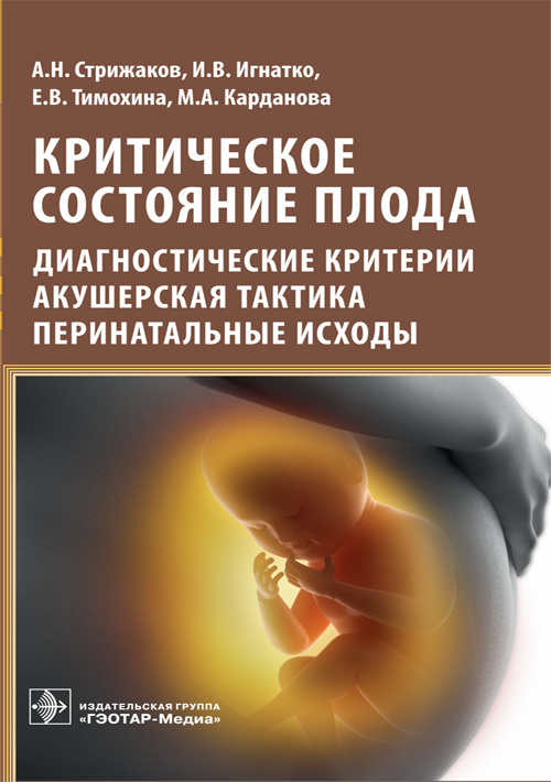 Критическое состояние плода : диагностические критерии, акушерская тактика, перинатальные исходы / А. Н. Стрижаков [и др.]. — М. : ГЭОТАР-Медиа, 2019. — 176 с