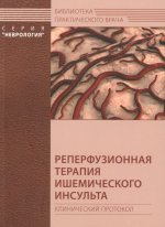 Реперфузионная терапия ишемического инсульта. Клинический протокол