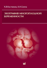 Эхография многоплодной беременности