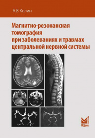 Магнитно-резонансная томография при заболеваниях и травмах центральной нервной системы