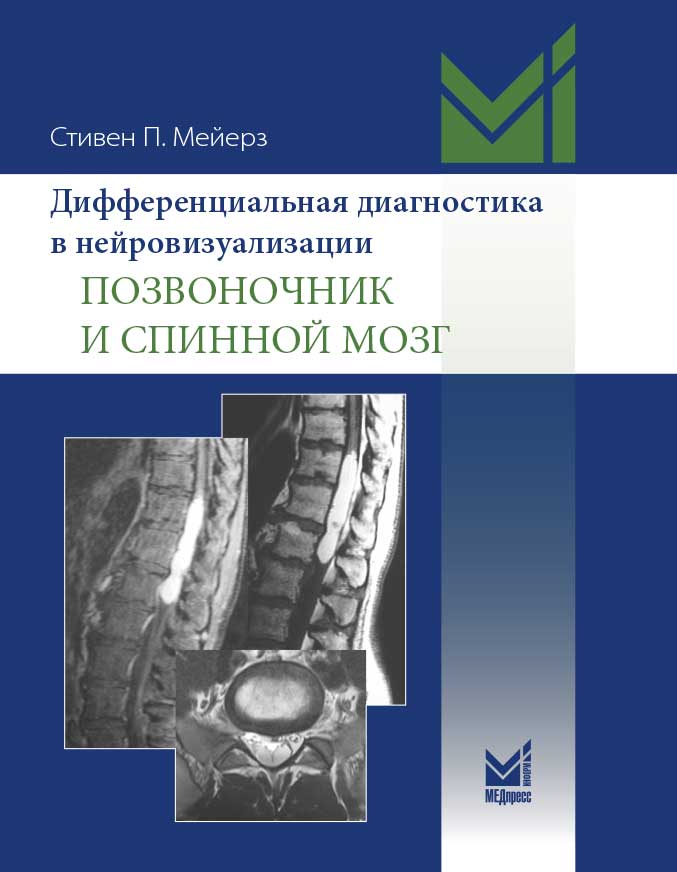 Дифференциальная диагностика в нейровизуализации. Позвоночник и спинной мозг