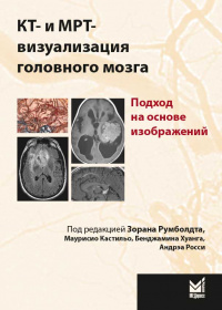 КТ- и МРТ- визуализация головного мозга. Подход на основе изображений