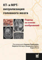 КТ- и МРТ- визуализация головного мозга. Подход на основе изображений