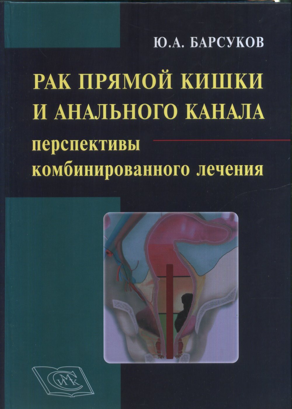 Рак прямой кишки и анального канала: перспективы комбинированного лечения. Руководство для врачей