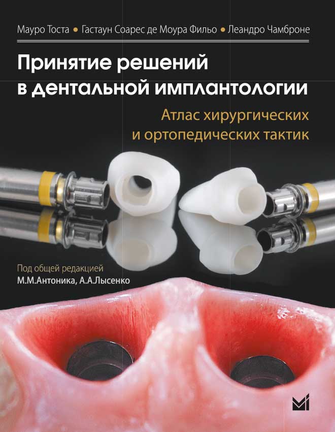 Принятие решений в дентальной имплантологии. Атлас хирургических и ортопедических тактик