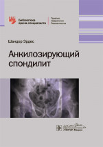 Анкилозирующий спондилит