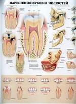 Нарушения зубов и челюстей. Височно-нижнечелюстной сустав